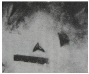 致伤物和致伤方式推断